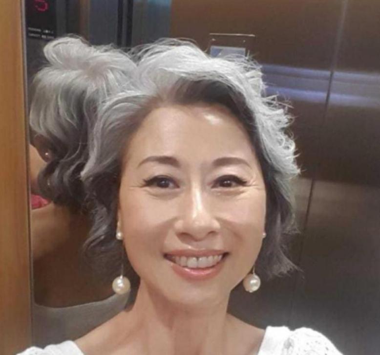 明星皱纹处理指南，对抗岁月痕迹的保养秘诀